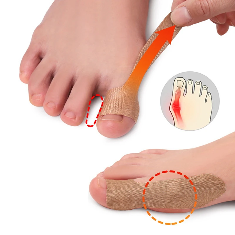 Non-woven Fabric Toe Separator Patches 5Sheets Bunion Hallux Valgus Corrector Thumb Correction Tenosynovitis Treat toe separator toe corrector bunion corrector thumb eversion corrector