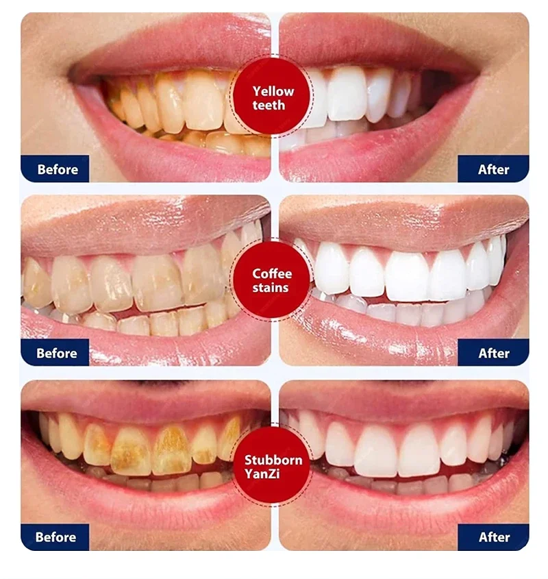 Fast Remove Smoke Stains Toothpaste Teeth Whitening Pen Remove Plaque Stain Oral Hygiene Cleaning Fresh Breath Dental Tools 120g teeth whitening product teeth whitening essence teeth health product