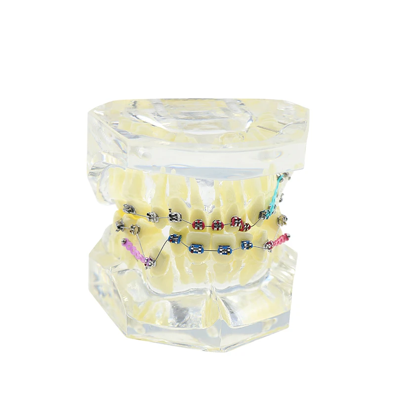 

Medical Model Orthodontic Model Transparent with Bracket Snaggle Toothed Malocclusion Orthodontic Model