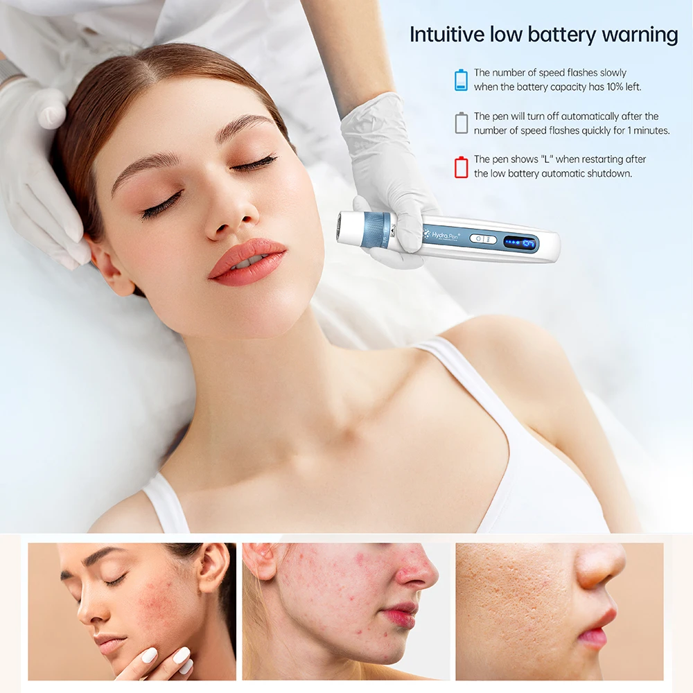 Microneedling Derma Pen Hydra Pen H5 Derma Microneedle Pen 4-pole EMS Microcurrent Mesotherapy Automatical Serum Applicator Repair Skin Beauty Tool