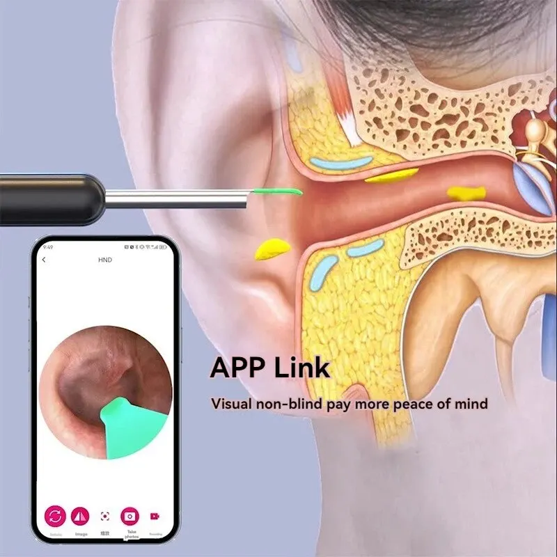 Wireless Ear Wax Remover Luminous Otoscope Ear Cleaner 1296P HD Visual Sticks Endoscope Mini Camera Health Care