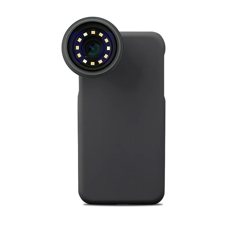 

Wireless Polarized Dermascope, Universal Smartphone Dermatoscope