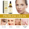 Bee Venom Anti Wrinkle Essence Anti-aging Polypeptide Hyaluronic Acid  Essence Can Repair Moisturize and Tighten Facial Skin 2