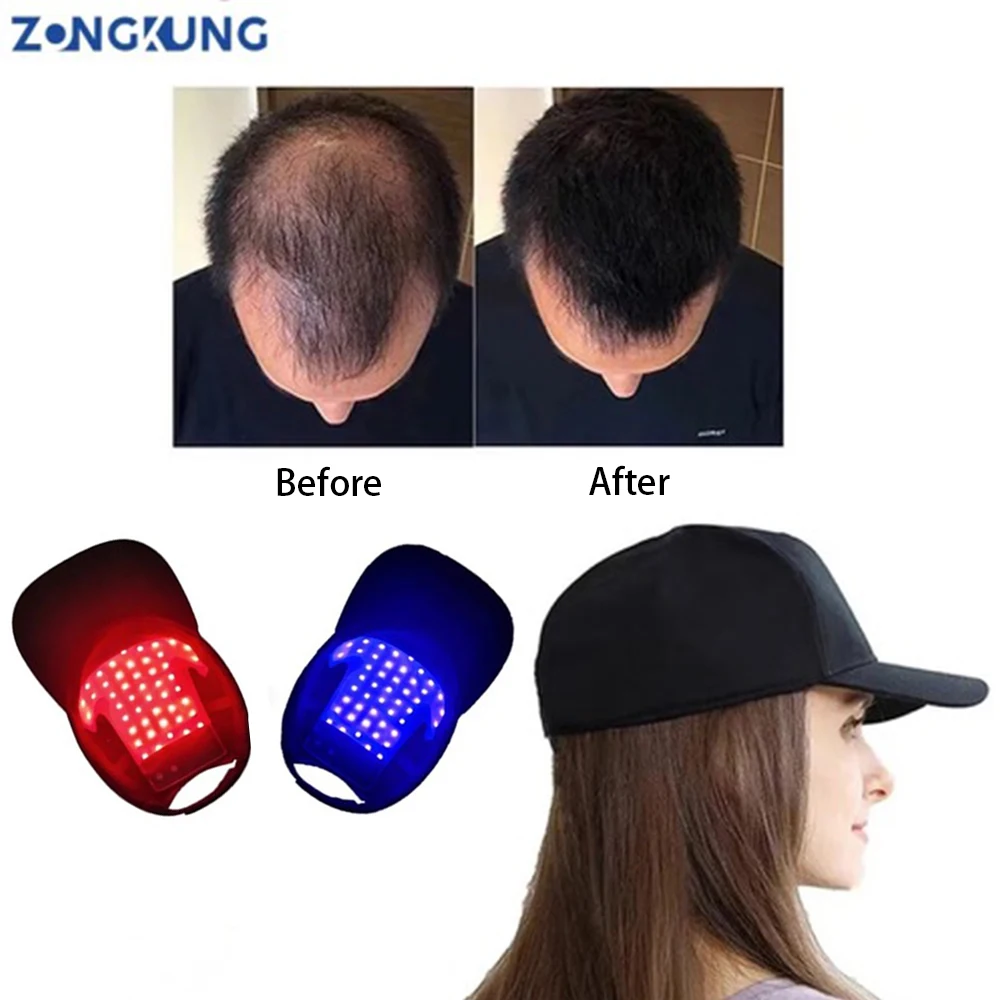 ZONGKUNG48PcsLEDsRedLightCapHairGrowthHatRedInfraredLight