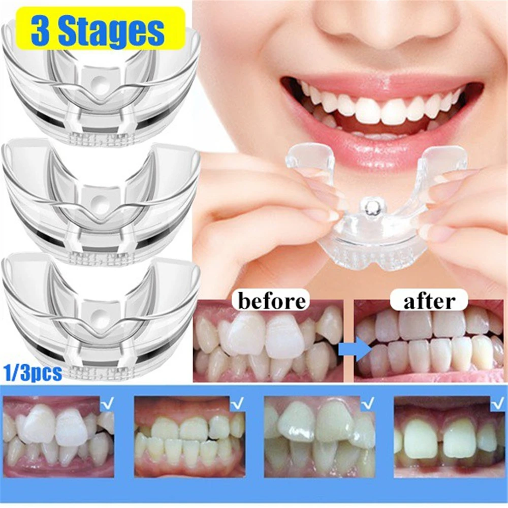 Ensemble Orthodontique Invisible en Silicone, Dispositif Dentaire, Retenue de Dents, Protège-Bouche, Bretelles, Outil de Soins Dentaires, 3 Étapes