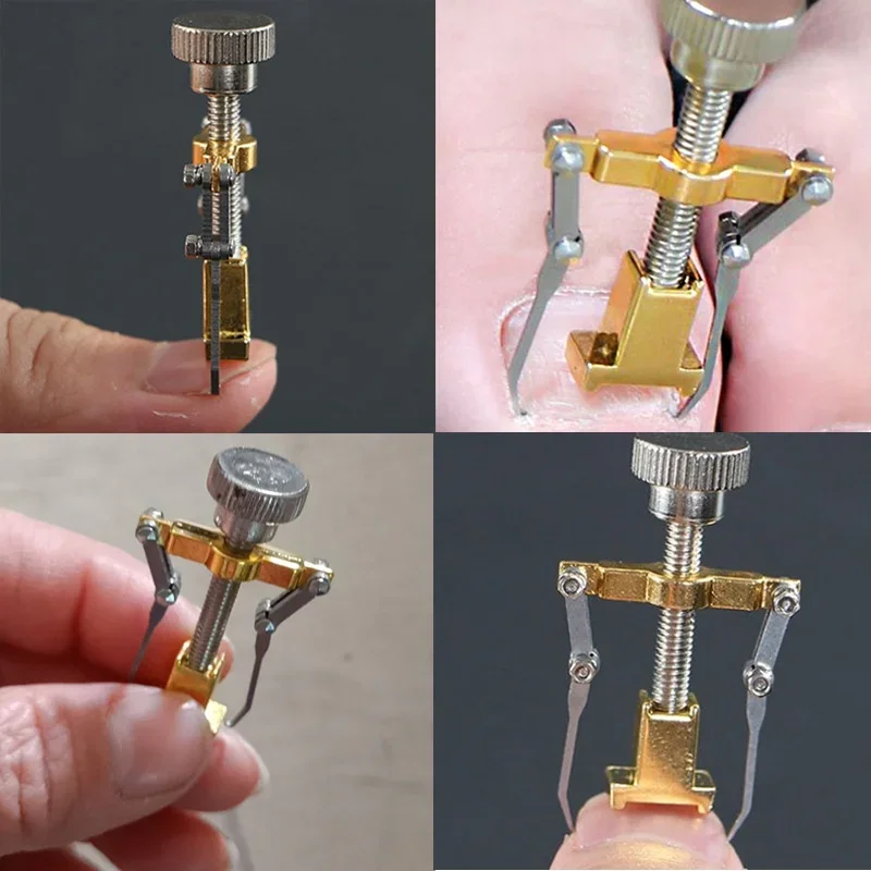 Ingrown Armor Toe Nail Correction Pedicure Fixer Straightener Clippers Recover Set Clamp Scissors Device Tool manicure pedicure kit manicure set manicure sets manicure nail clipper set nail clippers kit toe nail corrector