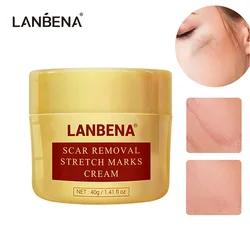 LANBENA Scar Removal Cream Acne Treatment Repairing Scar Non irritating Whitening Cream Anti Winkles Moisturizing Skin Care 40g