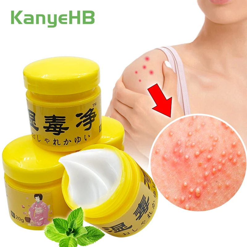 1pcs Genital Itch Relief Cream Scrotal Vulva Itching Tinea Cruris