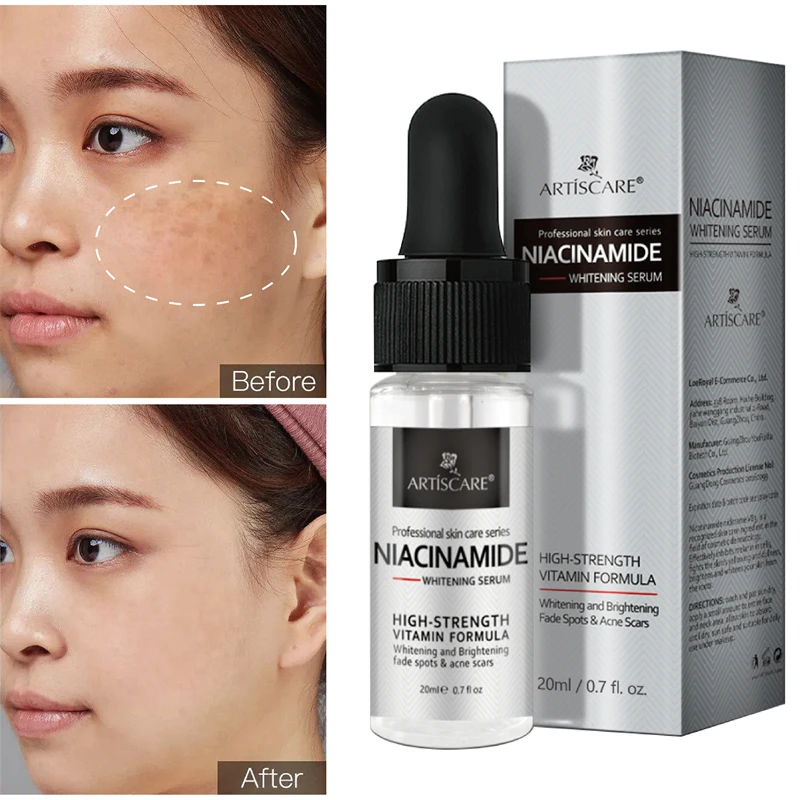 

Whitening Freckle Serum Niacinamide Remove Dark Spots Essence Anti Wrinkle Fade Melanin Pigmentation Melasma Brighten Skin Care