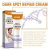 Dark Spot Corrector Cream Skin Lightening Blemish Removal Lotion Remove Melanin Melasma Knee Elbow Body Whitening Freckle Cream 4