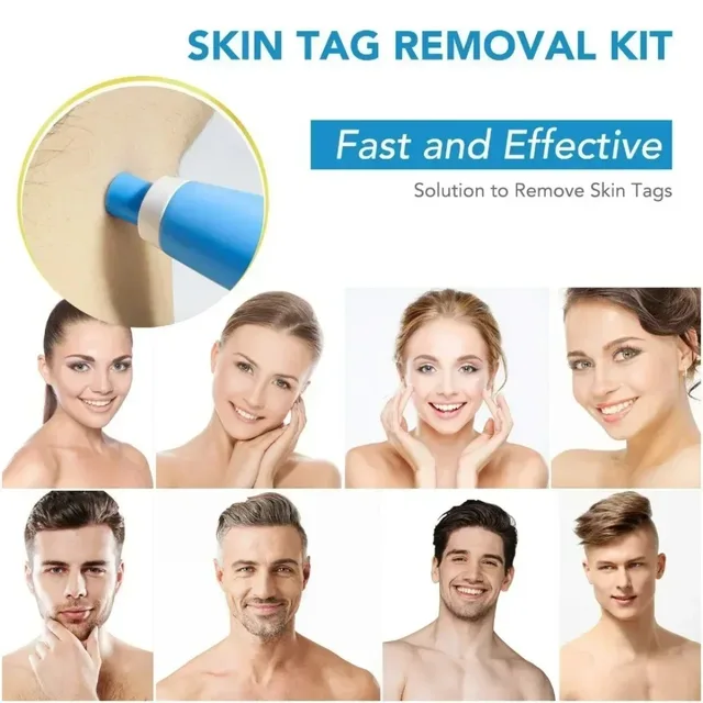2-IN-1 Auto Skin Tag Removal Tool Kit Painless Skin Label Mole Acne Wart Removal Pen with Cleansing Swabs Facial Skin Care Tool 3