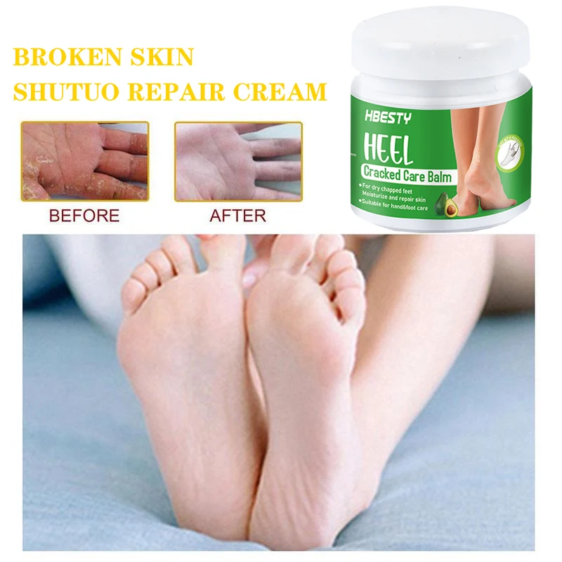 Рисунок 5 - Крем травяной для удаления трещин и зуда на пятках