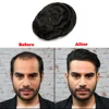 Men Toupee 0.03mm Thin Skin Invisible Human Hair System Male Wig Natural Hairline Men Wig Capillary Prosthesis Bald Hairpiece 4