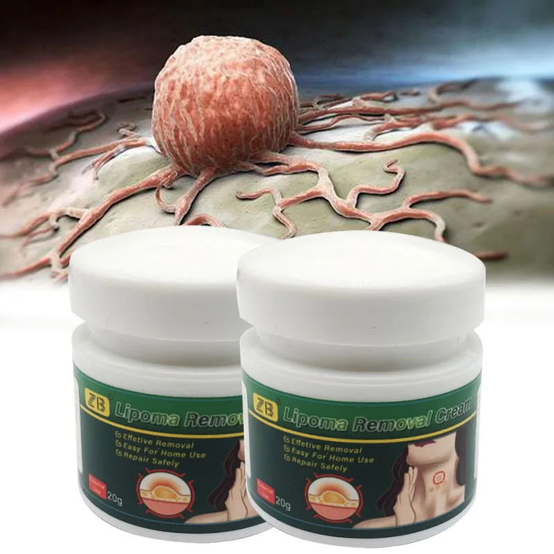 Skin Care Ointment 20g Herbal Lipoma Removal Cream Lipolysis Skin Swelling Cellulite Treatment
