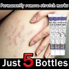 Eliminate Red White Old Stretch Marks Cream For Pregnancy Postpartum Skin Care Gel 1
