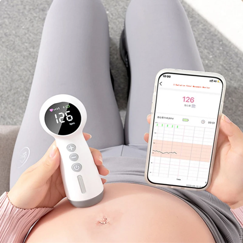 25mhzNoRadiationFetalHeartRateMonitorMultifunctionalBluetooth