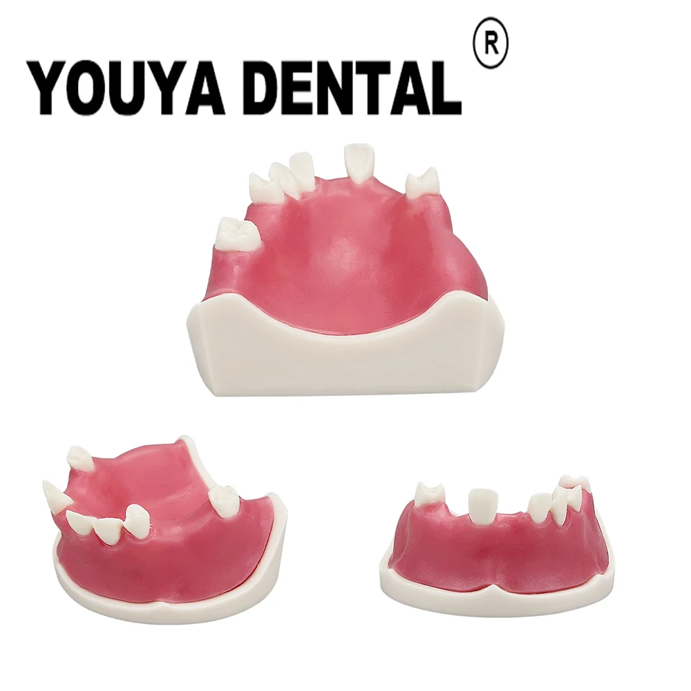 

Dental Implant Practice Model Teeth Studying Teaching Models for Dentist Technician Student Training Dentistry Tools