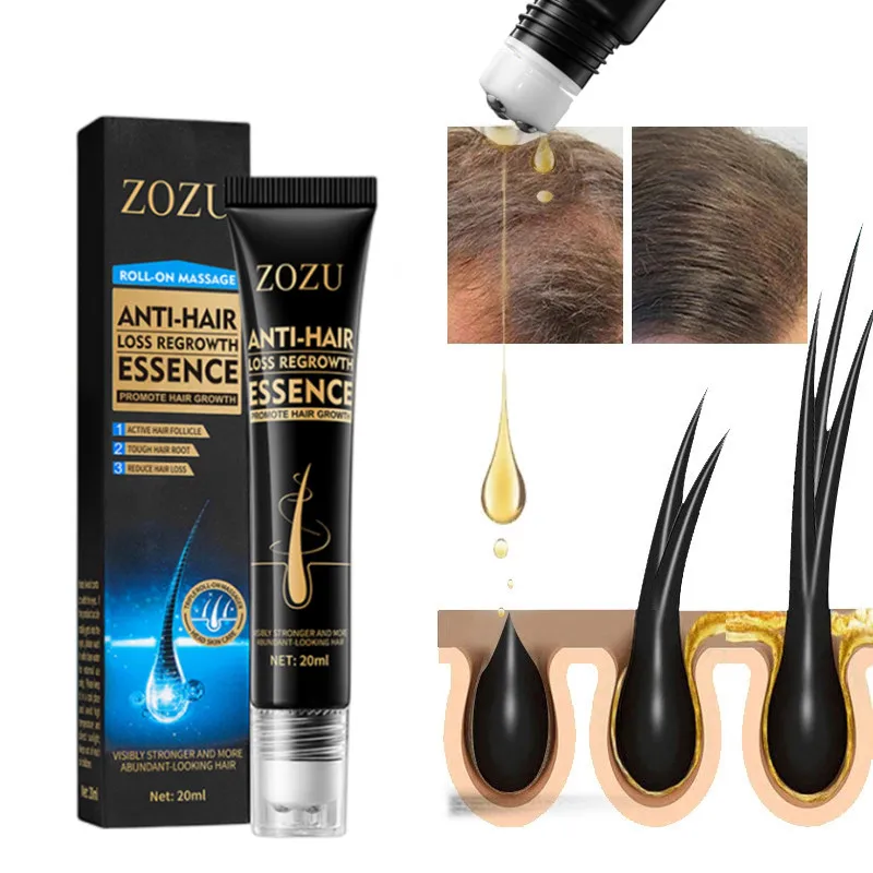 

20ML Regrowth Organic Hair Serum Roller Hair Care Anti Stripping Liquid Suitable For All Types Of Hair Loss Scalp Nourishing