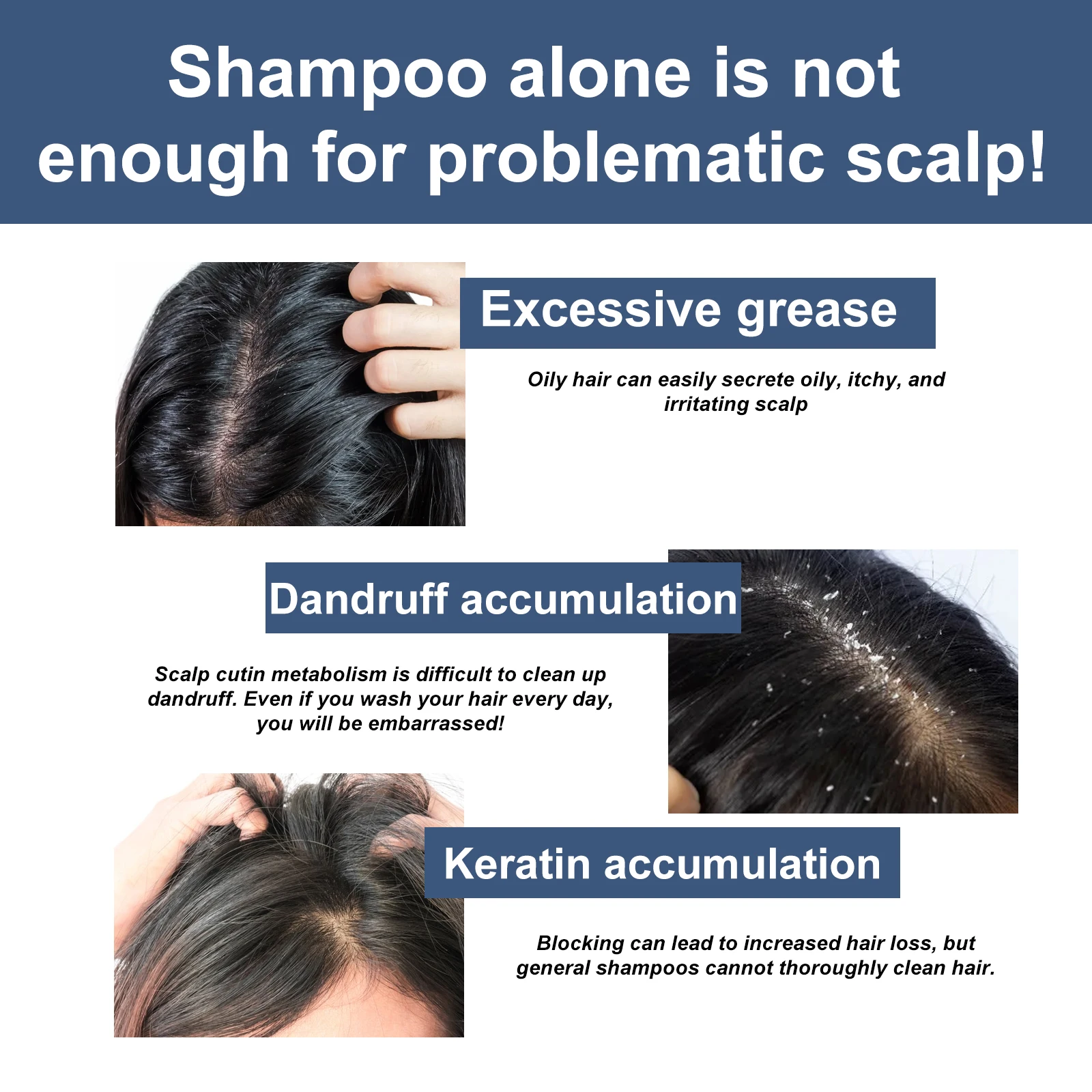 Eelhoe Scalp Exfoliator Scrub Moisturizes Scalp Improves Rough Deep Repair Moisturizes Dry Hair Clean Refreshing Scrub