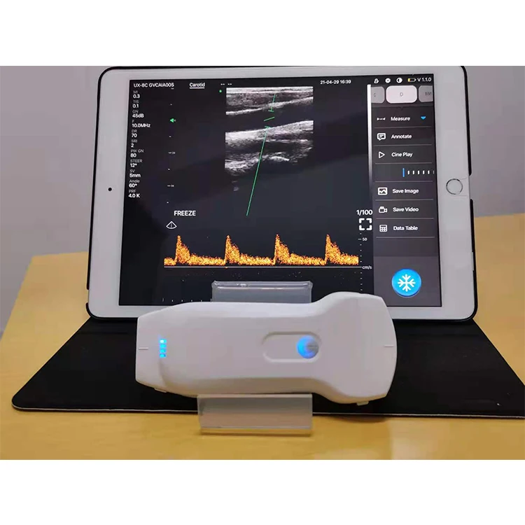 

Highest Cost-effective Handheld Portable 3 in 1 Wifi & USB Wireless Ultrasound Probe