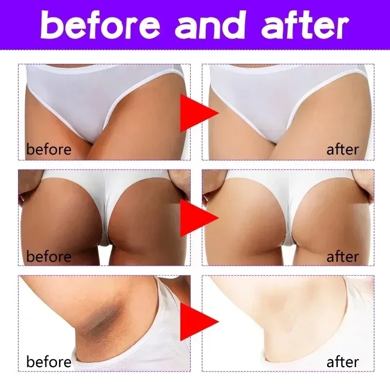 Whitening Body Cream Whitening Cream Brightening Cream Whitening Serum Brightening Body Cream Body Skin Care Cream Remove Dark Melanin Whitening Cream Private Parts Underarm Bleaching Serum Whiten Butt Knee Brighten Inner Thigh Intimate Parts