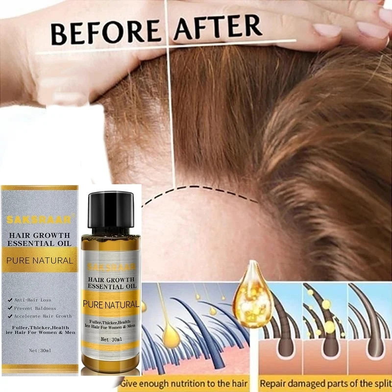 Ginger Oil for Hair Growth hair growth oil