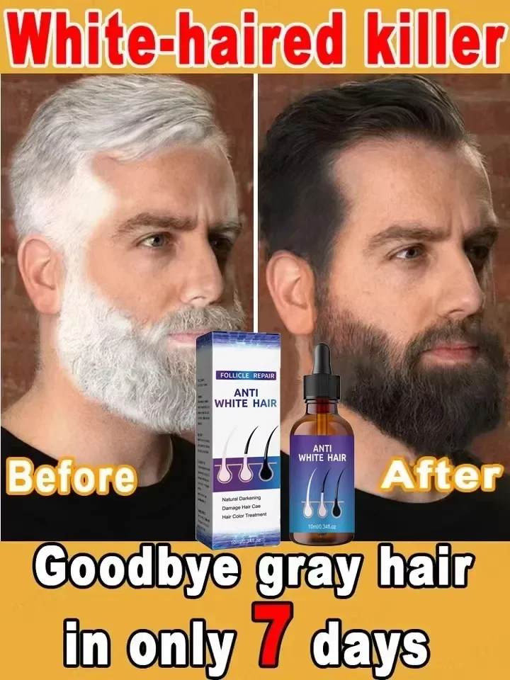 Natural Anti Gray Hair Serum-Repair White & Darkening Hair Nourishing Care Remedy anti gray hair serum