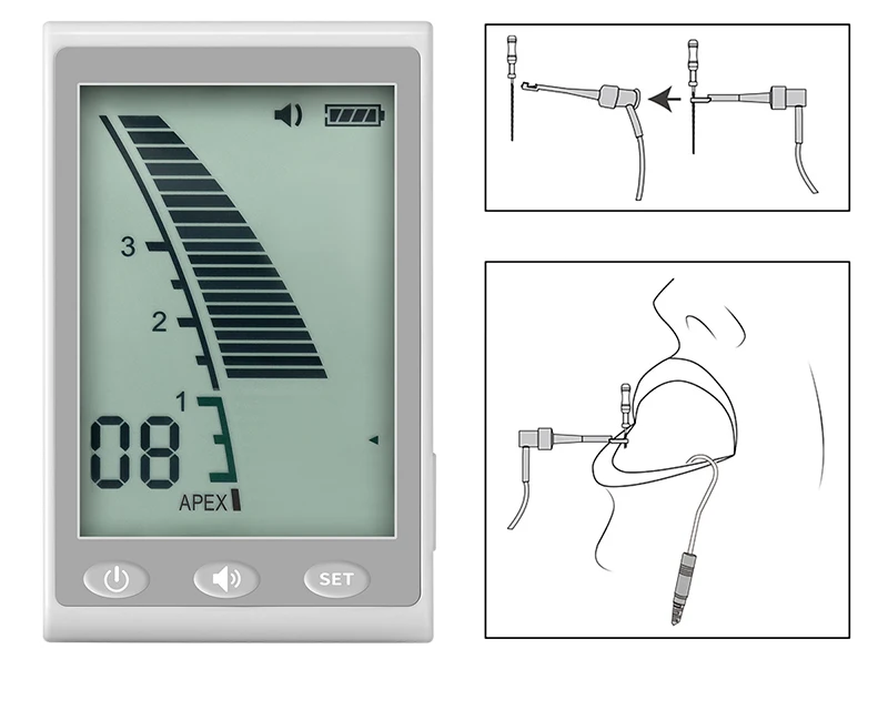 VVDental Micro Apical Locator Zahnarzt Tragbarer Apex Endodontie Locator Chirurgische Messung Endodontie Kanal Zahnmedizin Instrumente – Detail 4