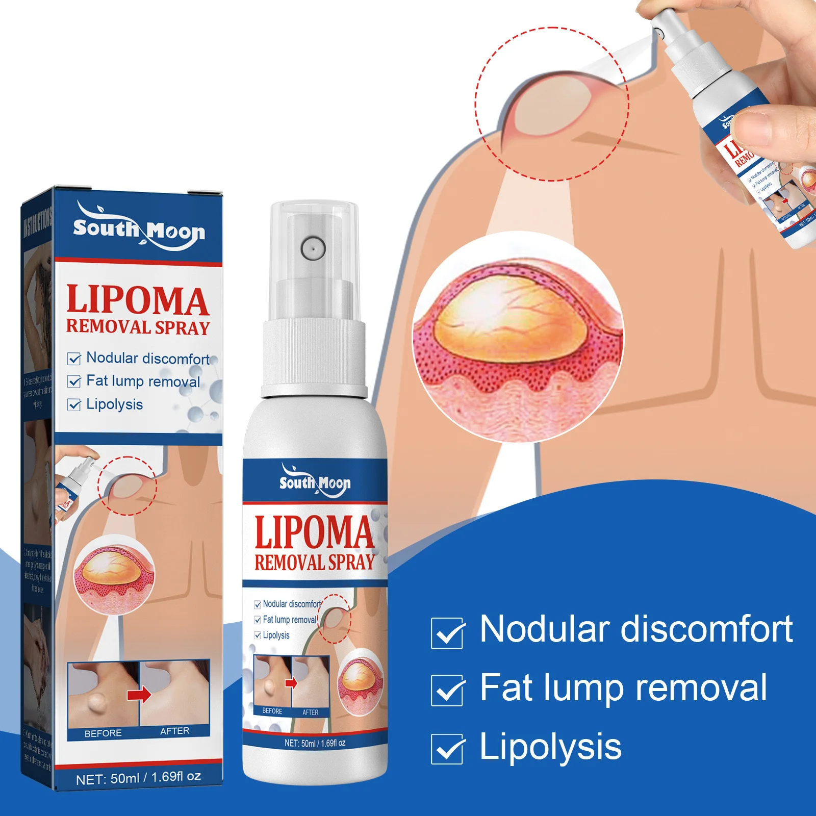 Skin Care Ointment Lipoma Removal Spray Treat Skin Swelling Cellulite Ointment Tumor Exfoliating Pain Relief
