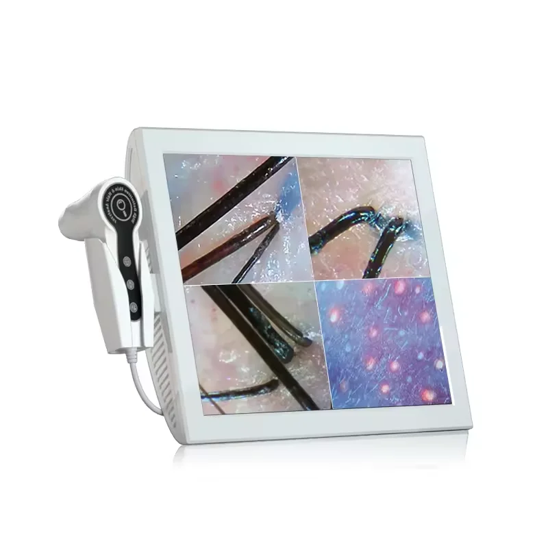 15 Inch HD Display 50/200X Professional Hair Follicle Detector Scalp Machine Oil Moisture Test Digital UV Skin Analysis Machine