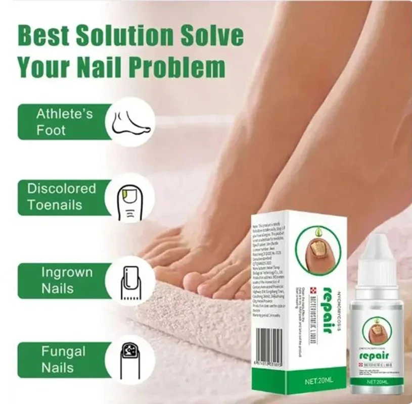 5Nail Fungals Renewal Nail Repair Liquid for Discolored Thickened Crumbled Nails Nail Fungals for Discolored Broken Cracked XXS5