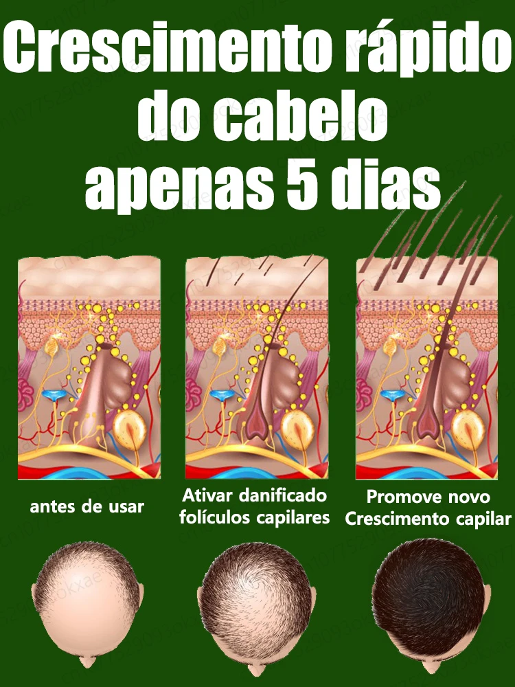 Óleo essencial anti-alopecia para o crescimento rápido do cabelo, soro gengibre