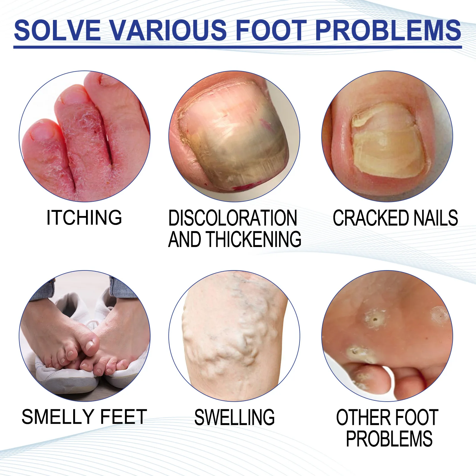 Foot Detox Cleansing Soak Beriberi Removal Nail Antibacterial Heel Anti Crack Relieve Fatigue Swelling Herbal Soothing Foot Bath