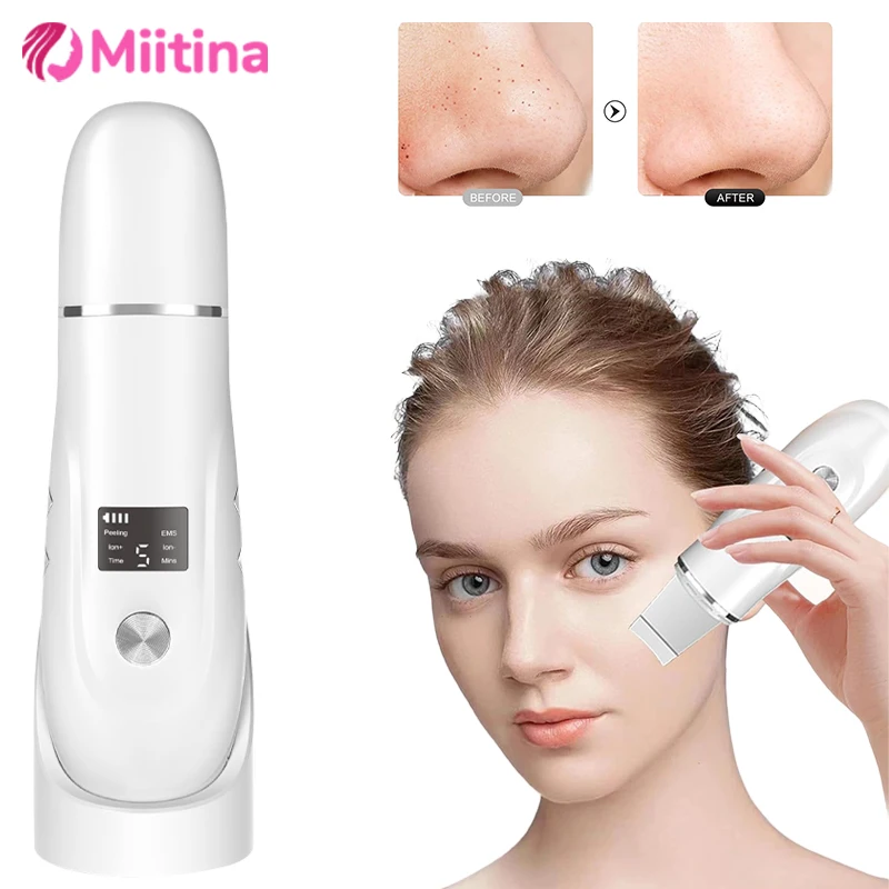 Electric ltrasonic Skin Scrubber Facial Cleansing Pore Deep Cleanser Acne Blackhead Remover Peeling Shovel Facial Lifting Device