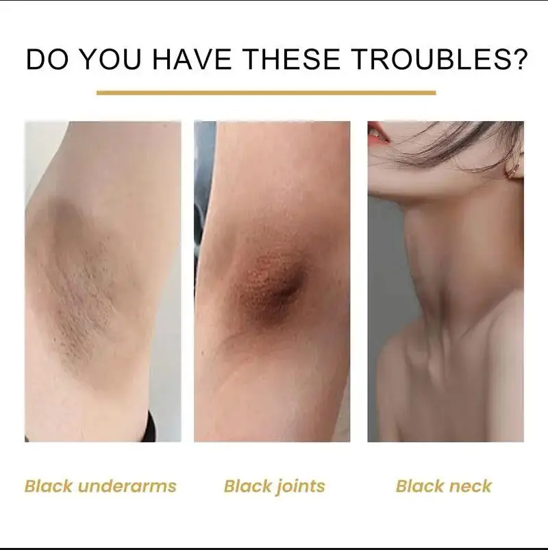 Рисунок 3 - Отбеливающее мыло для тела