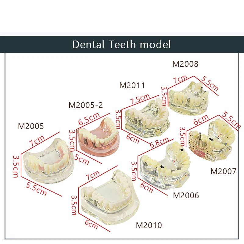 

Dental Caries Implant Model Dentist Teaching Research Model Transparent Model