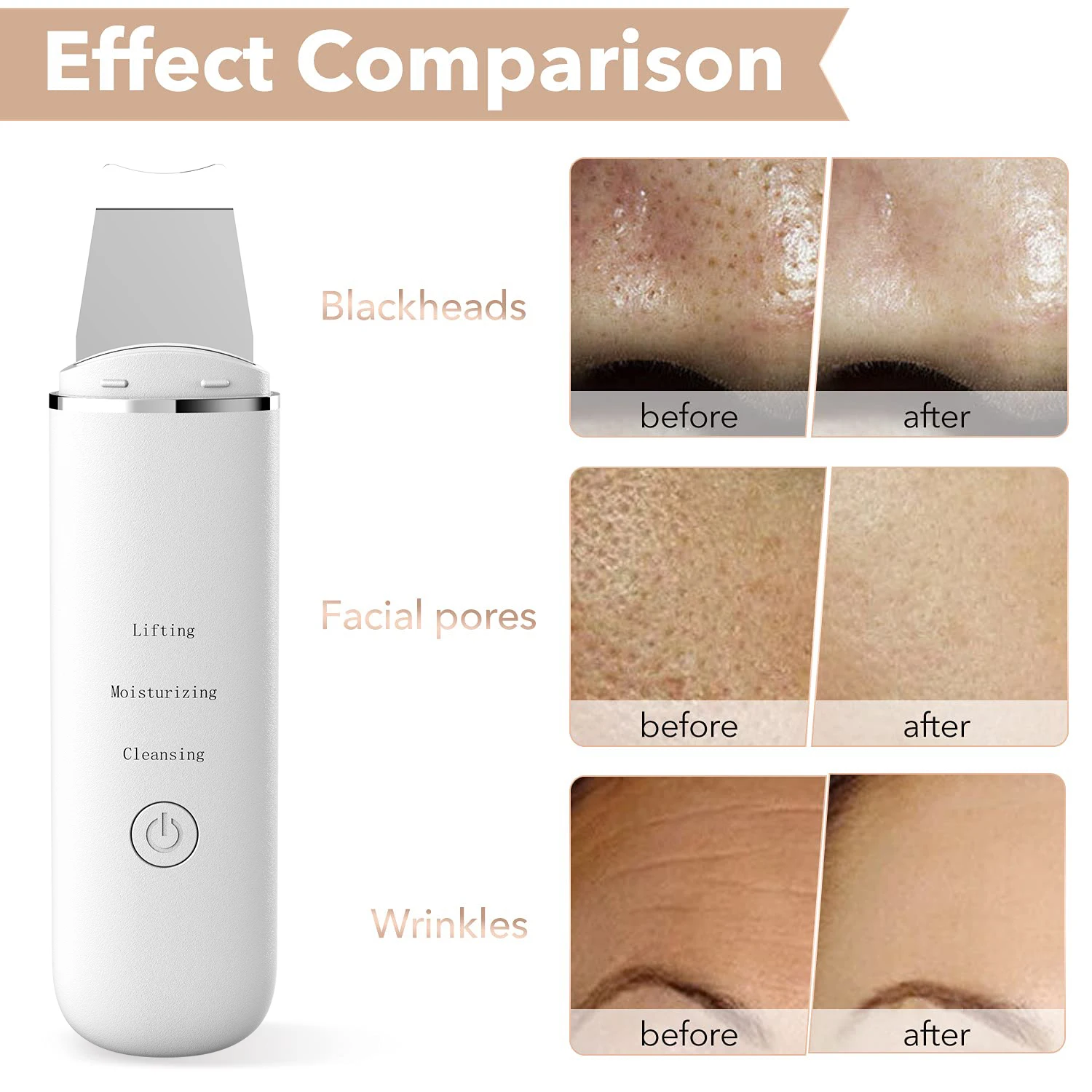 Ultrasonic Skin Scrubber Peeling Blackhead Remover Deep Face Cleaning Vibration Ion Acne Pore Cleaner Facial Shovel Scrubber