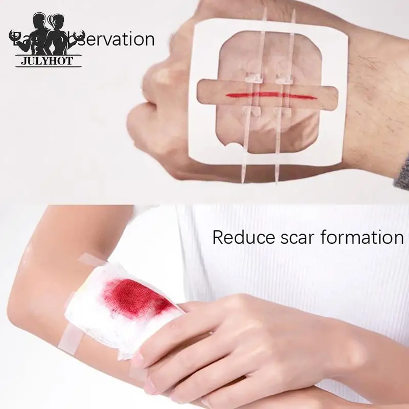 Image showcasing Zipper-Band-aid-Painless-Wound-Closure-Device-Suture-free-Wound ...