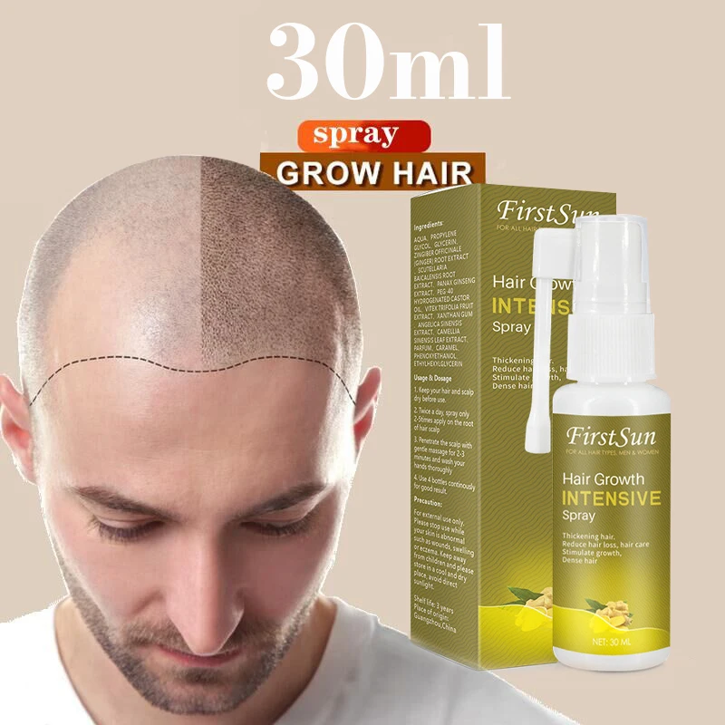 Ginger For Hair Growth Sprays Serum Ginseng Anti Hair Loss Products Scalp  Treatments Nourishing Hair Roots Beauty Healthy Care - Hair Loss Product  Series - AliExpress