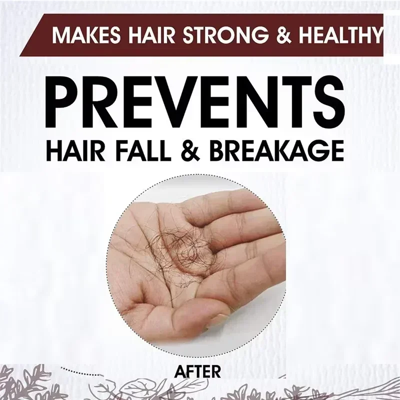 Effective Nurture Hair for Men Women Ginger Oil Care Anti Postpartum Hair Loss Scalp Treatment Serum Hereditary Products