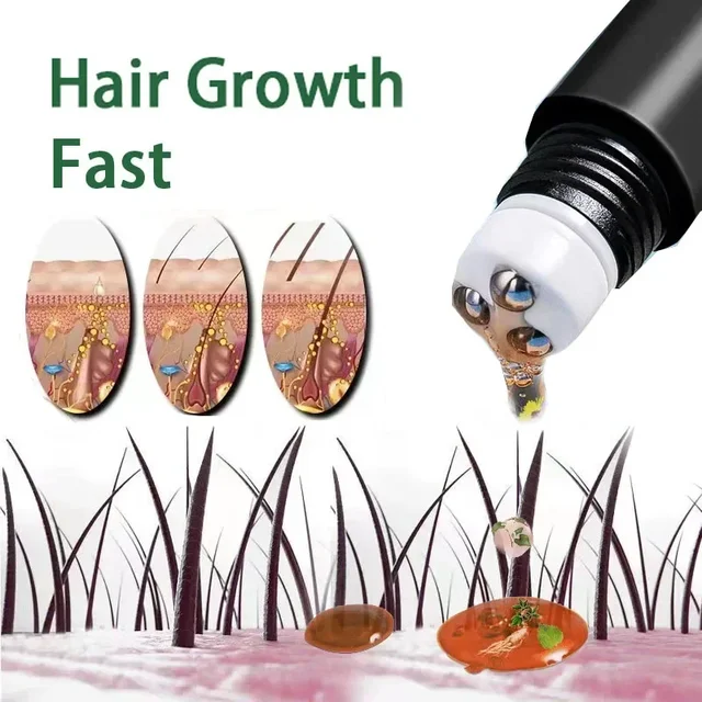 Huile de croissance rapide des cheveux à la biotine pour hommes, produits de soins, traitements de massage du cuir chevelu, anti-chute de cheveux, croissance efficace, sérum capillaire ThUNICEF 1