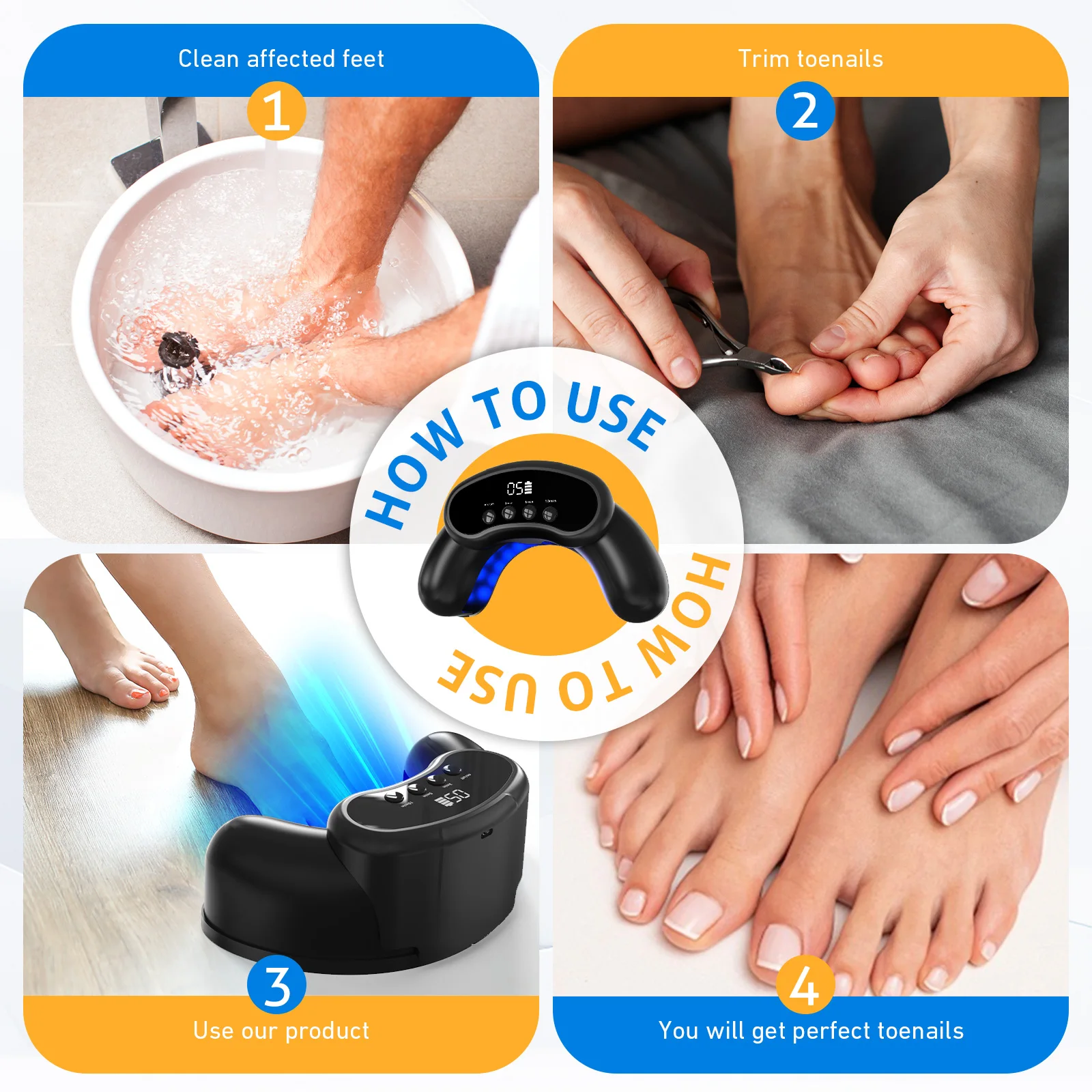 מכשיר לייזר פטריות אלחוטי לציפורניים 30 חרוזים מכשיר טיפול בפטריות לציפורניים אוניכומיקוזיס 470nm בלתי נראה 905nm