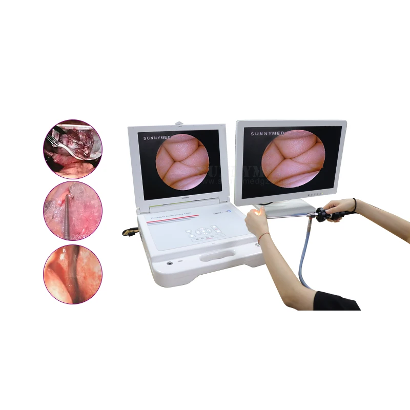 

Флуоресцентная хирургия, Электронная жесткая эндоскопическая система, Лапароскопия для продажи