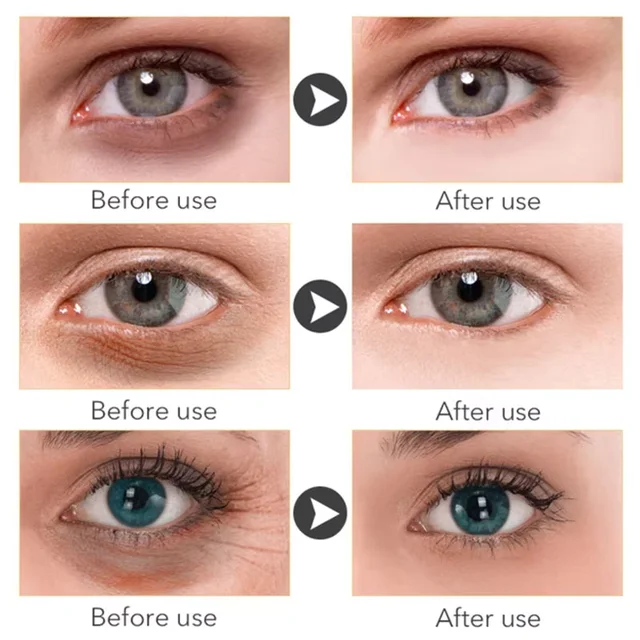 Anti Dark Circle Eye Serum Oil Retinol Anti Wrinkle Firming Skin Remove Eye Bag Fade Fine Line Whitening Brighten Eye Care Korea 2