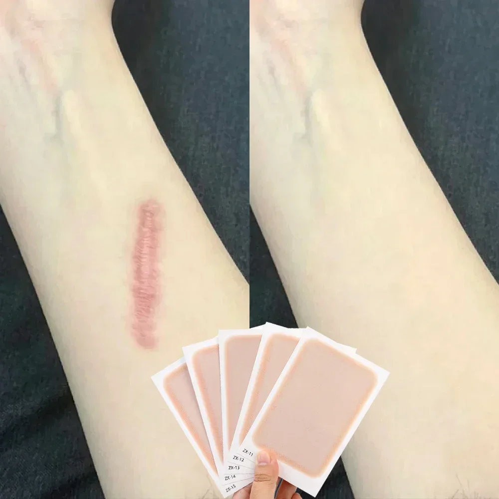 Waterproof Temporary Tattoo Concealer Stickers for Acne Scar Cover