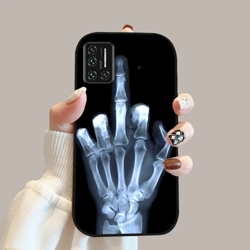 Animal-Themed Shockproof Silicone Phone Case - Soft, Durable Protection