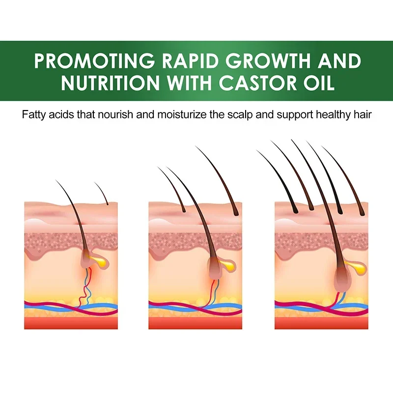 Olio di ricino nero organico per la crescita dei capelli del cuoio capelluto Denso Rafforzamento dei capelli Prevenzione della caduta dei capelli Riparazione Liquido nutriente - immagine 5