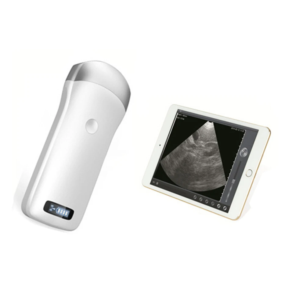 

Handheld Abdomen Ultrasound Scanner Machine Probe for Tablet and Smartphone