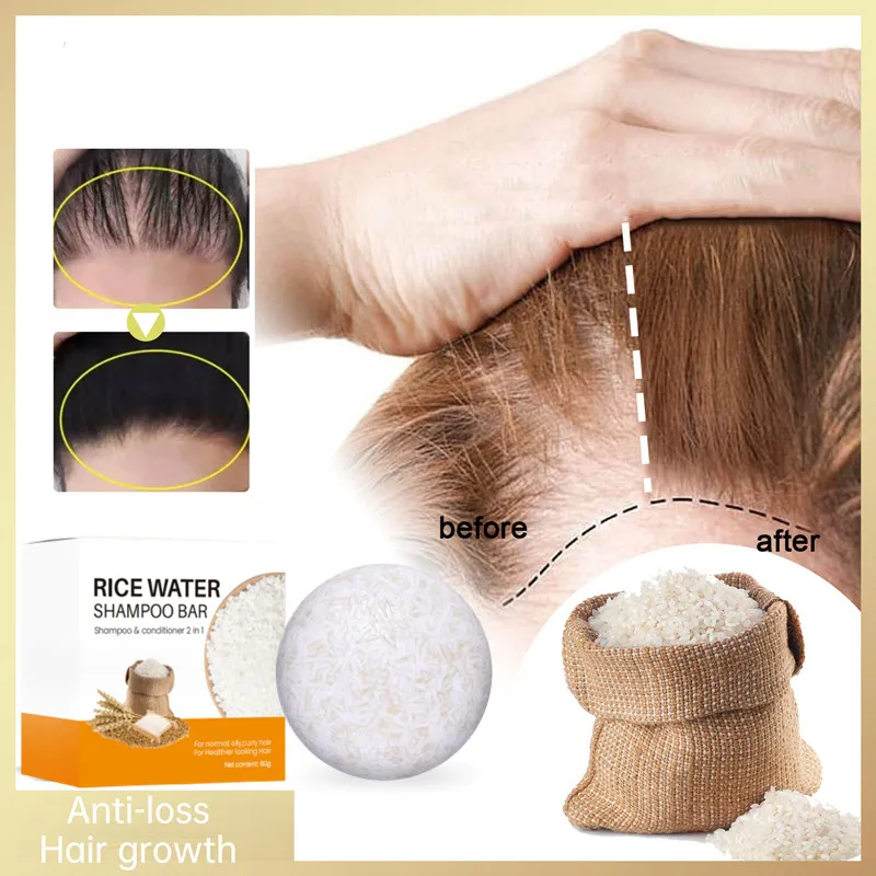 

Rice Water Hair Growth Soap Hair Scalp Cleansing Shampoo Bar Anti-hair Loss Nourish Handmade Soap Hair Care Unisex Hair Growth