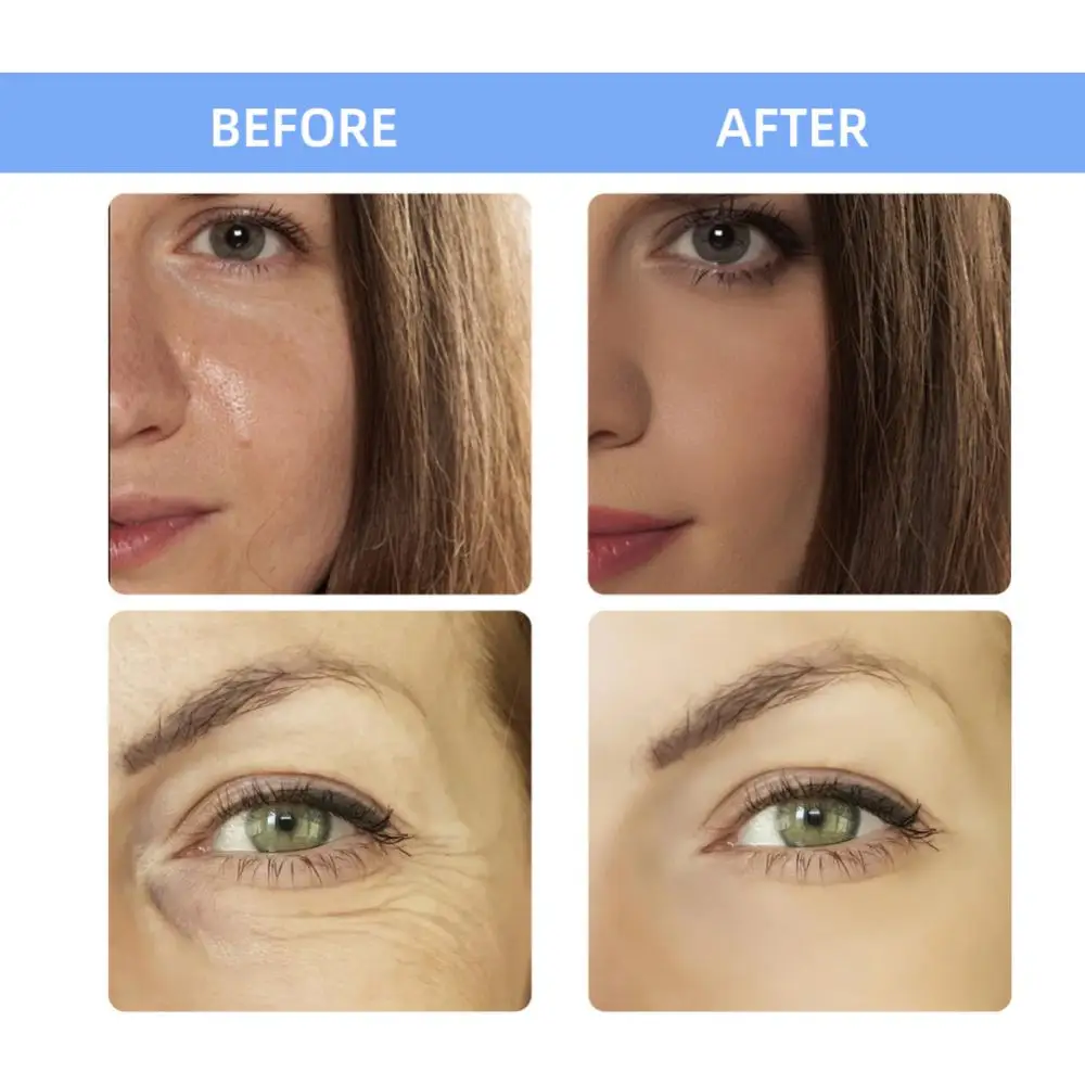 Рисунок 3 - 5 флаконов/коробка 135HA